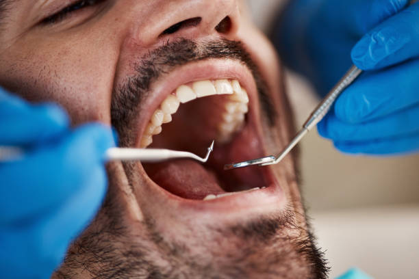 Best Emergency Broken Tooth Repair in Alexandria, KY